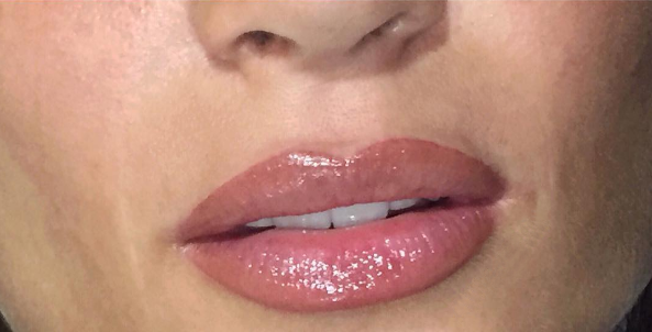 natural permanent lips chelmsford