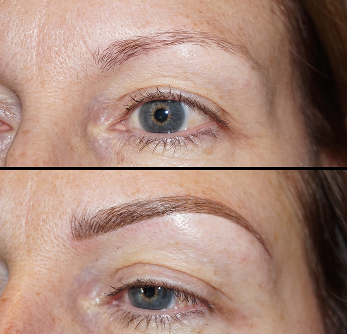 Microblading Chelmsford